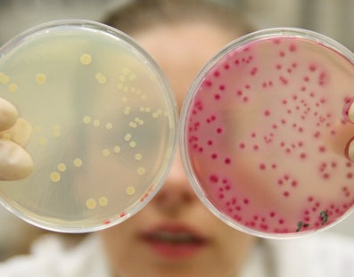 Laborante laat twee petrischaaltjes zien met verschillende bacteriekweken