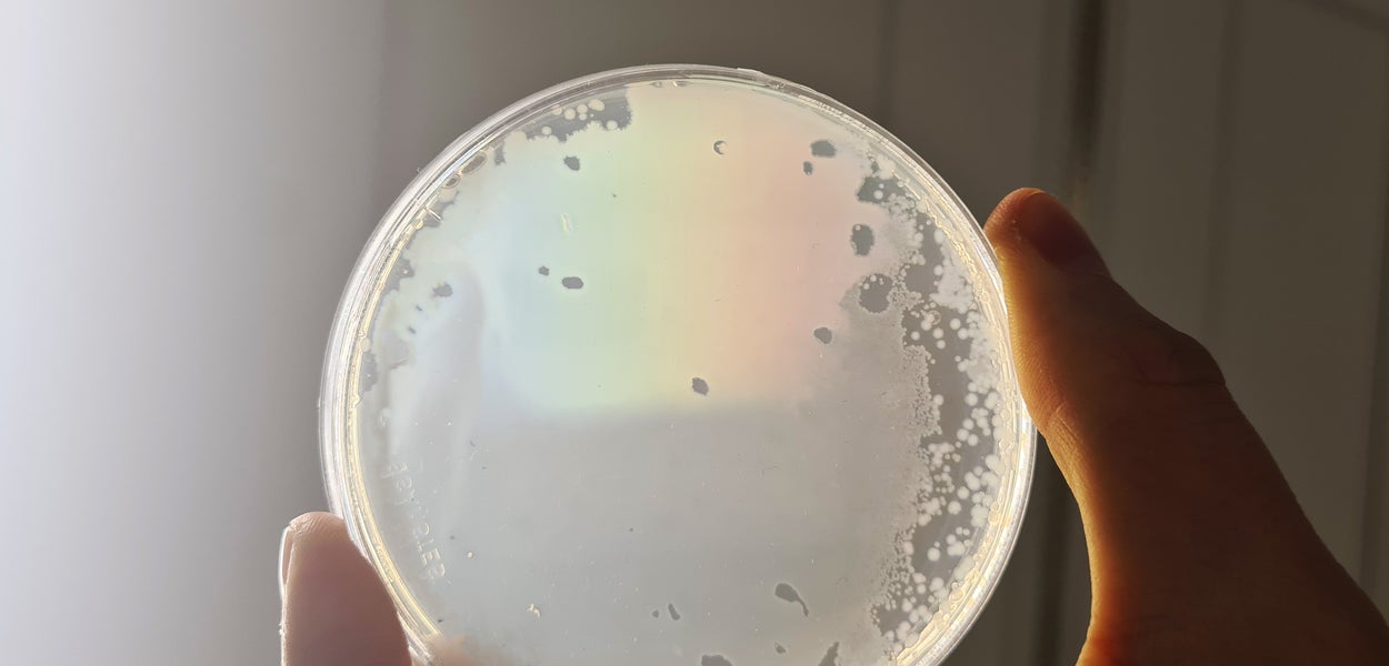 Bacteriën in een petrischaaltje